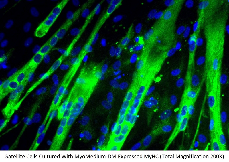 Human Skeletal Muscle Cell Differentiation Medium