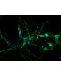 <b>NEW!<b/> Rat Neurons-midbrain