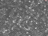 Human Seminal Vesicle Smooth Muscle Cells