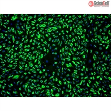 Human Dermal Microvascular Endothelial Cells-adult, Passage 1
