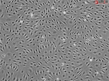 Cryopreserved Human Hepatic Sinusoidal Endothelial Cells, Passage 1, Single Donor