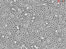 Cryopreserved Human Primary Conjunctival Epithelial Cells, Passage 1
