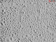 Cryopreserved Human Primary Conjunctival Epithelial Cells, Passage 1