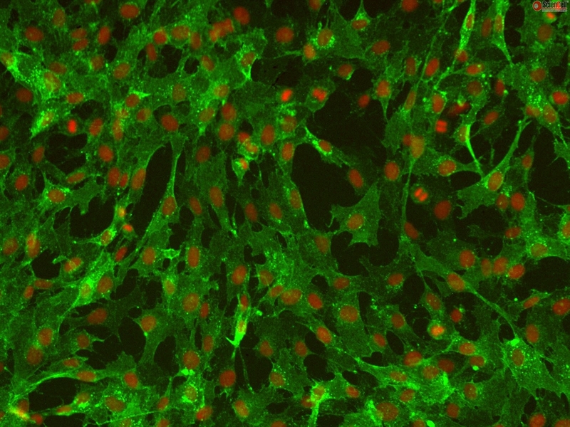 Human Leptomeningeal Pericytes, Passage 1