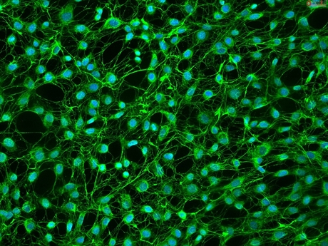 Human Primary Dural Fibroblasts, Passage 1