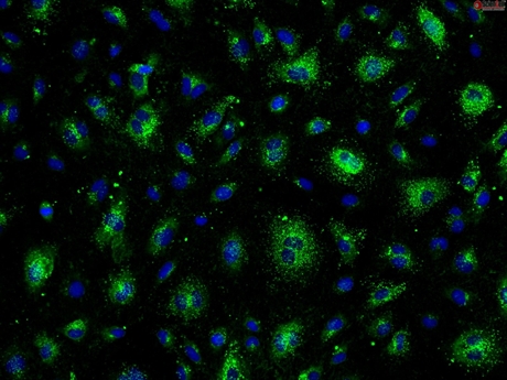 Human Dural Microvascular Endothelial Cells, Passage 1