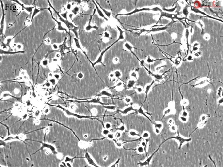 Human Cerebellar Granule Cells (HCGC), Passage 0