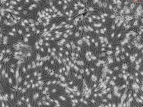 Human Epidermal Melanocytes-medium, HEM-m, Passage 1