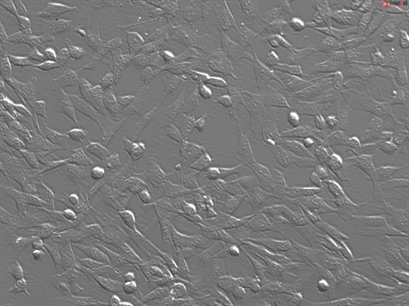 Human Scalp Fibroblasts-fetal
