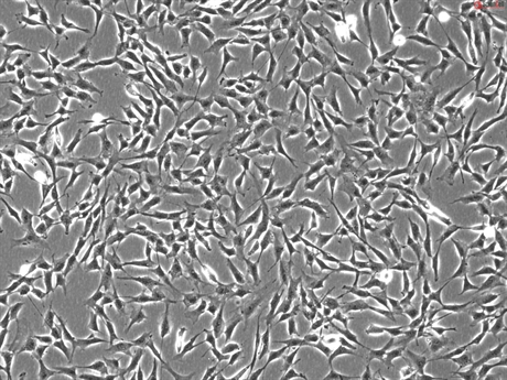 Human Middle Ear Fibroblasts