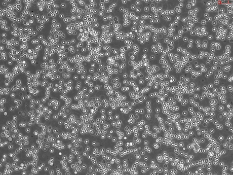 Human Lymphatic Mononuclear Cells-mixed population of T cells, B cells, and NK cells