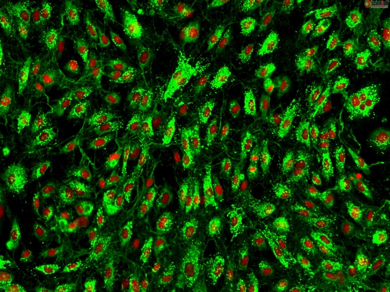 Human Tonsil Endothelial Cells, Passage 1, HTEC