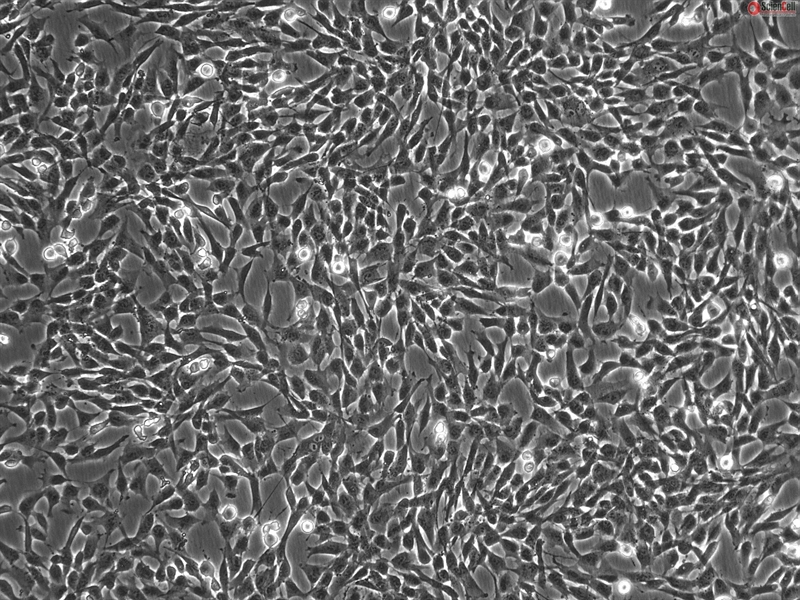 Human Gastric Fibroblasts