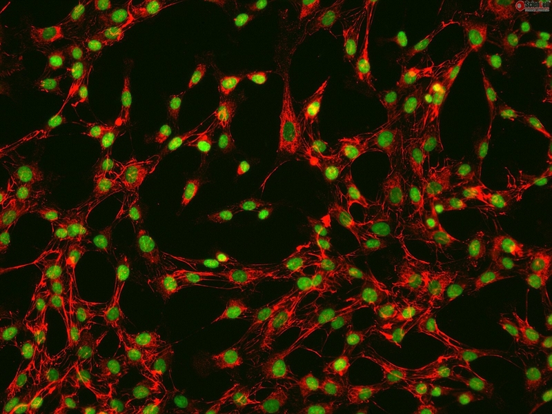 Human Rectal Fibroblasts