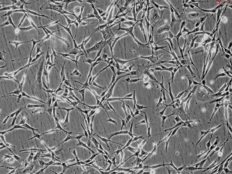 Human Bronchial Fibroblasts