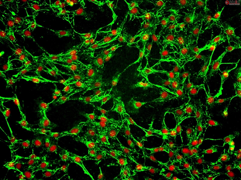 Human Tracheal Fibroblasts