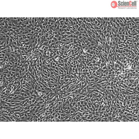 Human Skeletal Muscle Myoblasts