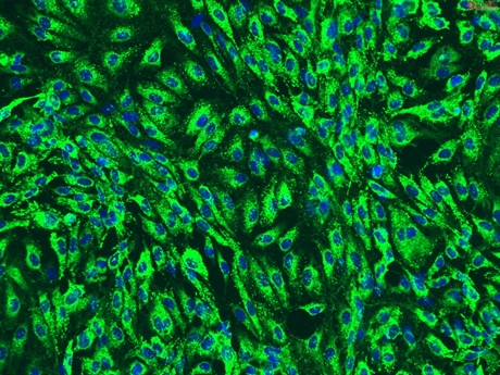 Human Pancreatic Microvascular Endothelial Cells, Passage 1