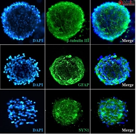 All-Inclusive 3D Human Cortical Spheroid Formation Kit