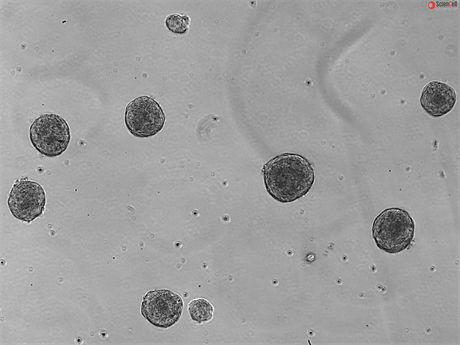 All-inclusive 3D Osteogenesis-Angiogenesis Coupling Kit