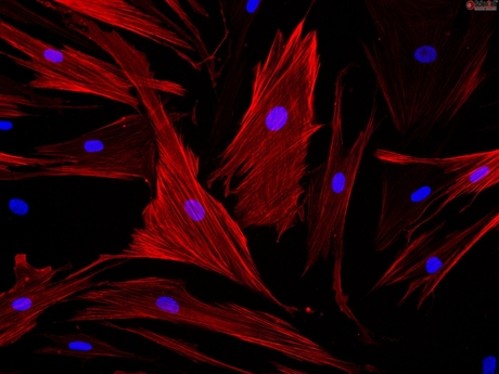 Human Seminal Vesicle Smooth Muscle Cells