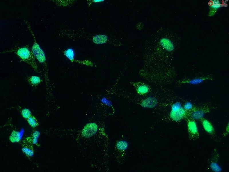 Human Hepatic Macrophages