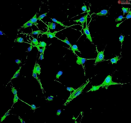 Human Aortic Adventitial Fibroblasts