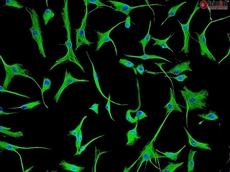 Human Cardiac Fibroblasts-adult