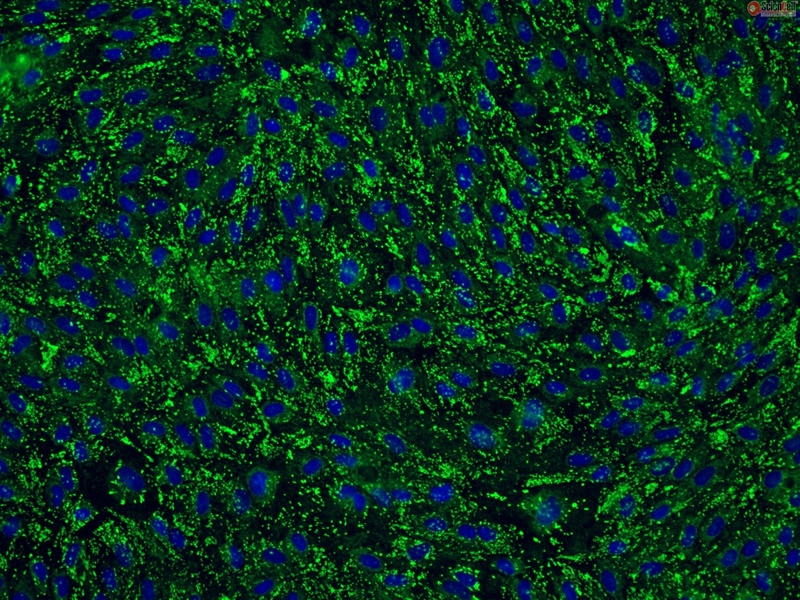 Human Cervical Microvascular Endothelial Cells, Passage 1