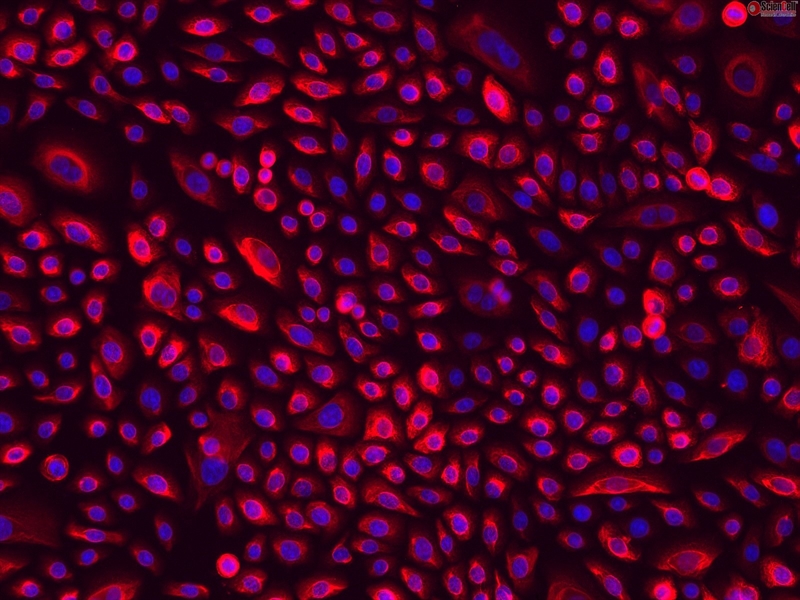 Human Cervical Epithelial Cells, Passage 1