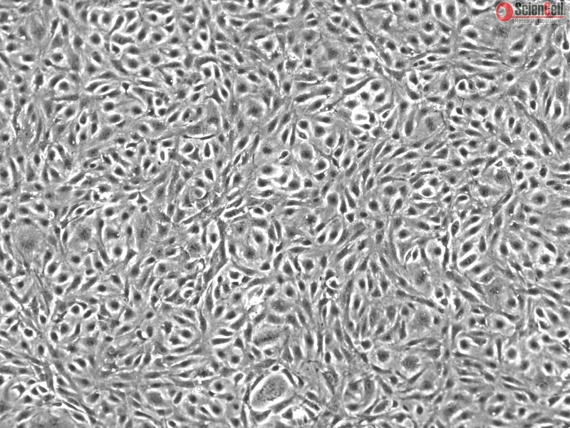 Human Adipose Microvascular Endothelial Cells, Passage 1