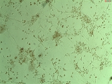 Colorimetric TUNEL Apoptosis Assay