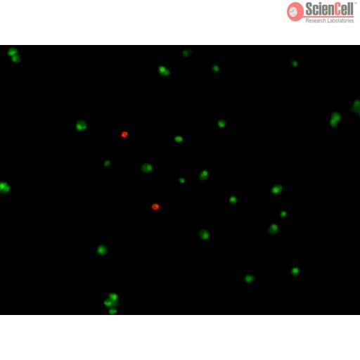 Colorimetric Calcium Assay