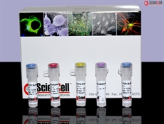 Mycoplasma PCR Detection Kit For Cell Cultures, 16S rRNA-based PCR Assay 