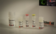 Citrate Synthase Assay