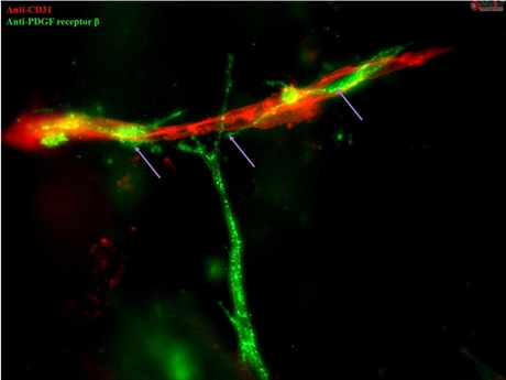 Human Blood Brain Barrier Modeling Kit