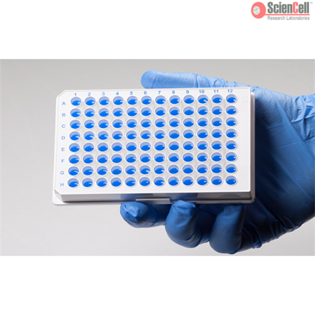 GeneQuery™ Human VIM-VIM2P  Pseudogene Transcription Analysis qPCR Kit (GQP-VIM2P)