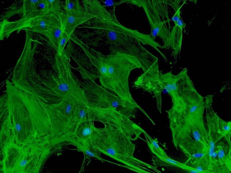 Mouse Brain Vascular Pericytes from CD1, Passage 1