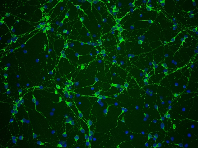 Mouse Neurons-spinal cord from CD1