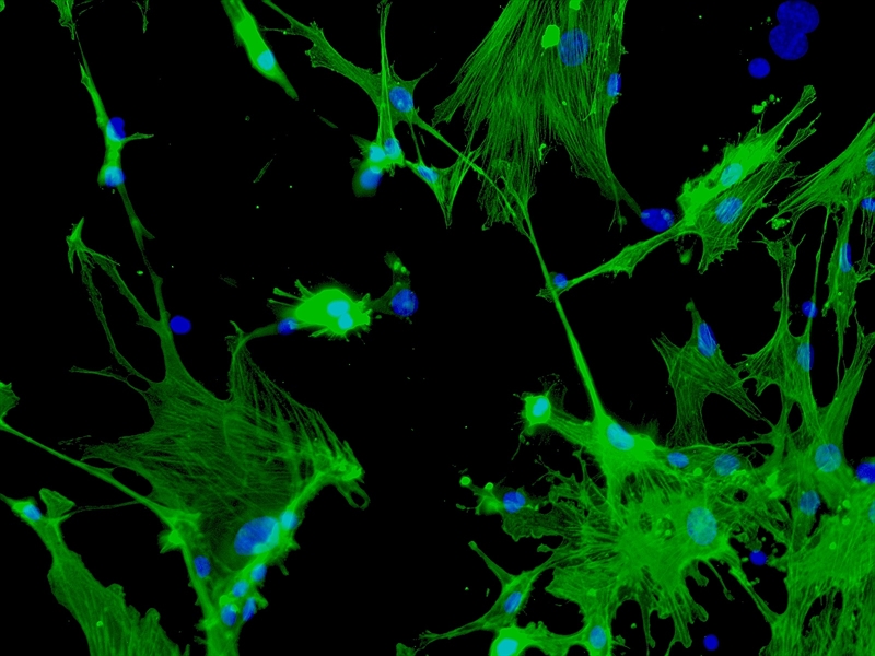 CD1 Mouse Hepatic Stellate Cells