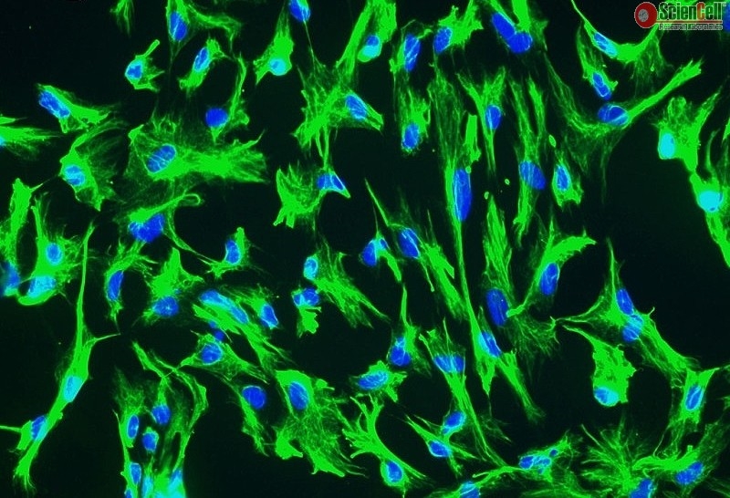 Primary Human Choroid Plexus Epithelial Cells