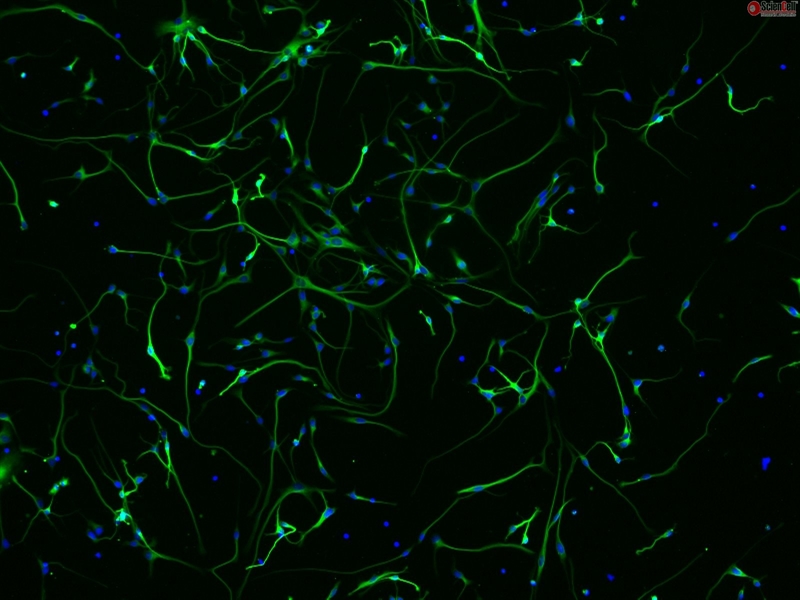 Human Primary Neurons