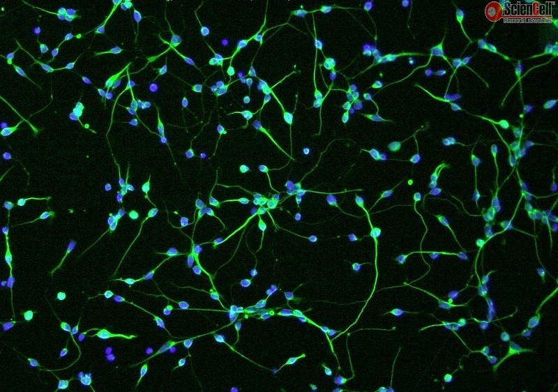 Human Oligodendrocyte Precursor Cells, HOPC