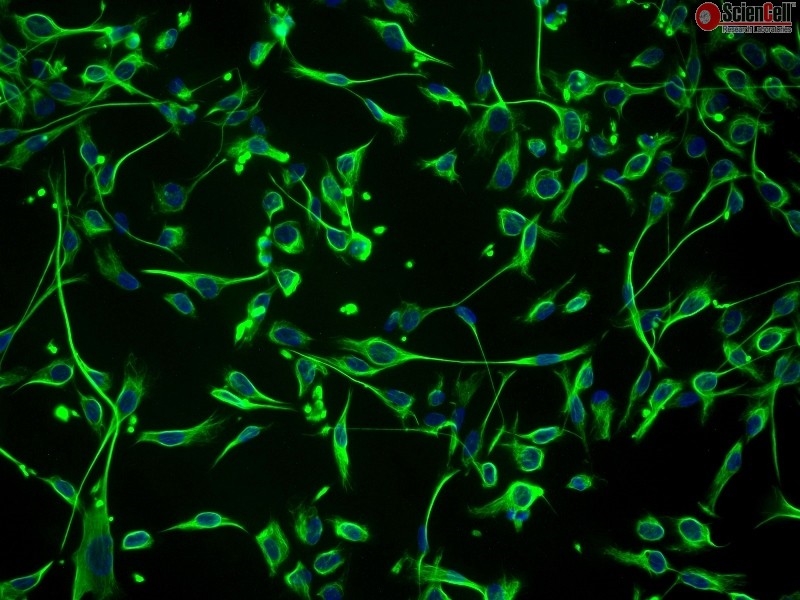 Cryopreserved Human Primary Schwann Cells, Passage 1, 10 population doublings