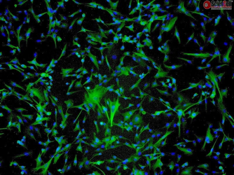 Human Astrocytes-spinal cord, GFAP+, Passage 1