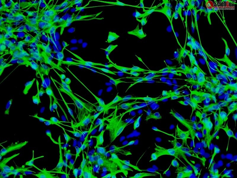 Human Astrocytes-brain stem, GFAP+, Passage 1