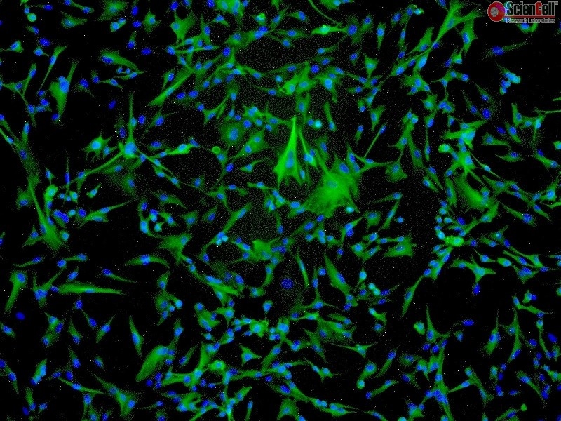 Human Primary Astrocytes, midbrain, Mesencephalon, GFAP+, Passage 1