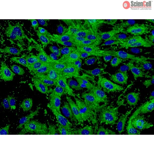 Human Dermal Microvascular Endothelial Cells, HDMEC, Passage 1