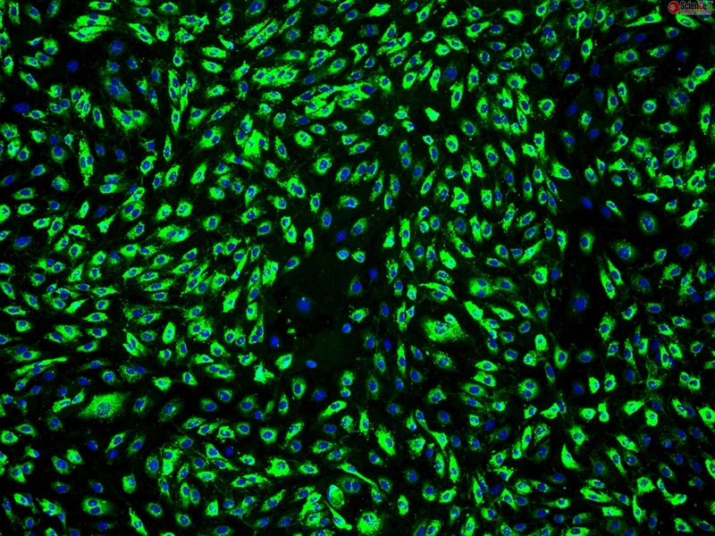 Human Dermal Microvascular Endothelial Cells-adult, Passage 1