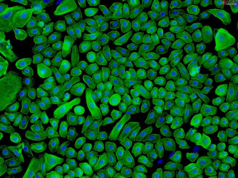 Human Epidermal Keratinocytes-neonatal